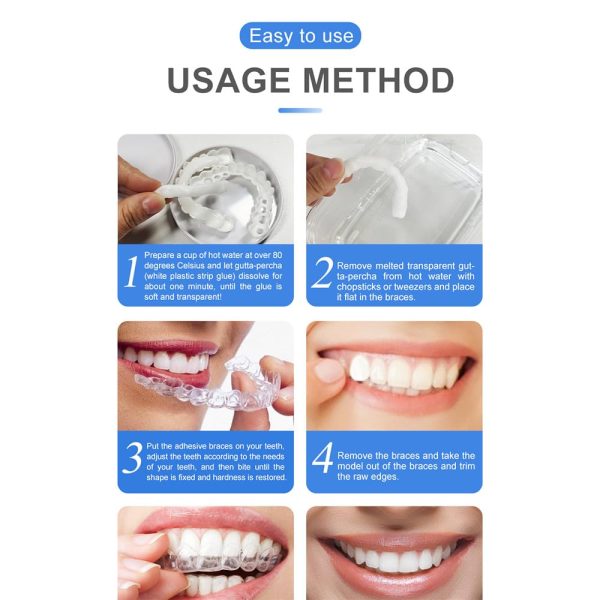 Snap-on Smile For Beautiful Smiles